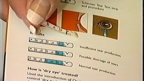 Thumbnail for entry Treating conjuntivitis (dry eye) in the dog