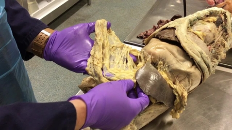 Thumbnail for Anatomy of the gastrointestinal tract in the dog: Greater omentum