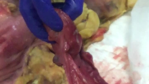 Thumbnail for Reproductive tract in the mare: Clip 2