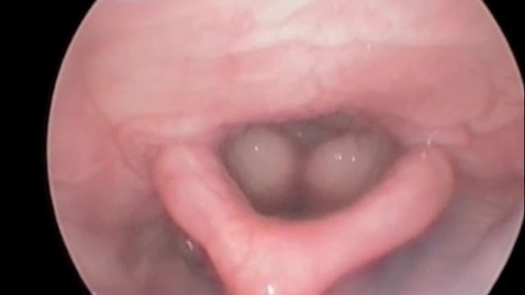 Thumbnail for Laryngoscopy in the pug