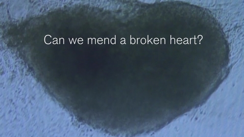 Thumbnail for Can we mend a broken heart?