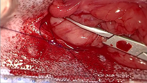 Thumbnail for entry Ovariohysterectomy in the bitch: Ligation of the ovarian pedicle using modified Miller's knot