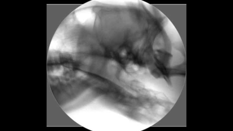 Thumbnail for Fluoroscopy of the  swallowing dysphagic dog