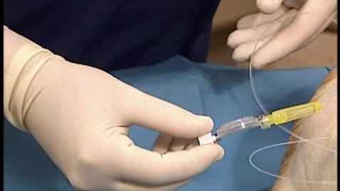 Thumbnail for Inserting an epidural catheter