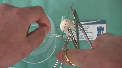 Thumbnail for Ovarian pedicle ligation: Modified Miller's knot