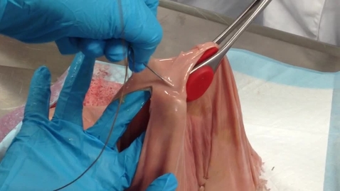 Thumbnail for Suturing the uterus following a caesarean section in the cow