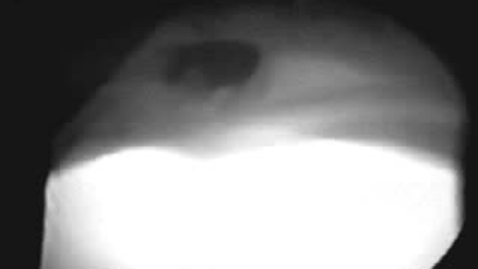 Thumbnail for Fluoroscopy of the neck in the drinking dog