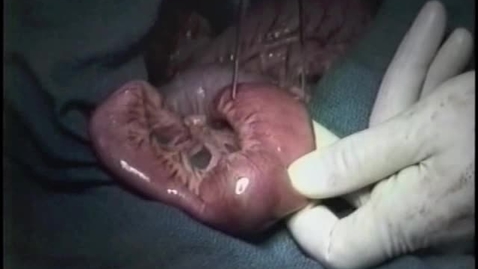 Thumbnail for entry Removing a foreign body from the small intestine in the dog