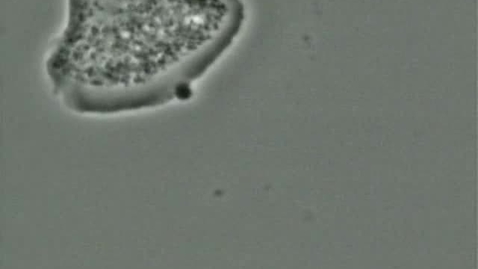 Thumbnail for Cell biology: Phagocytosis