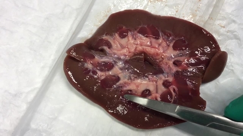 Thumbnail for Anatomy of the kidney in the pig and primate