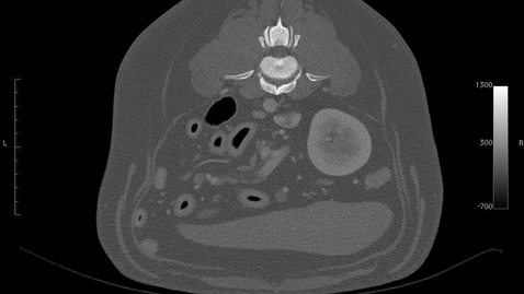 Thumbnail for Abdominal imaging