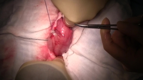 Thumbnail for entry Gastrotomy for a gastric foreign body in the dog