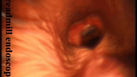 Thumbnail for URT endoscopy in the dynamic horse showing a displaced soft palate: Clip 1