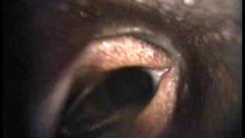 Thumbnail for URT endoscopy in the dynamic horse showing a displaced soft palate: Clip 2