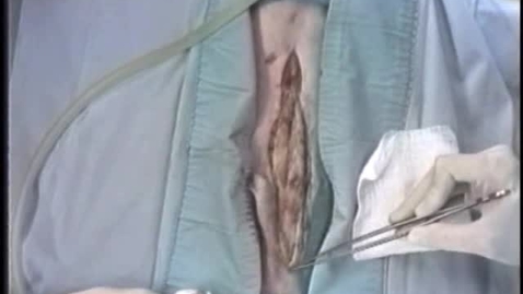 Thumbnail for Performing an exploratory coeliotomy in the dog