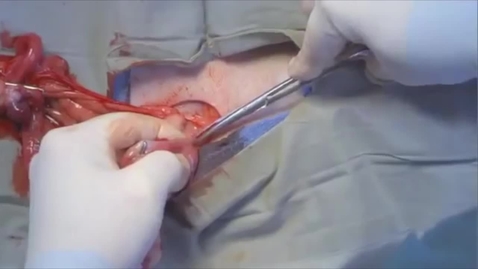 Thumbnail for entry Ovariohysterectomy in the bitch: Breaking the suspensory ligament