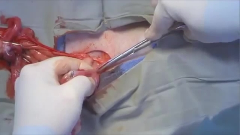 Thumbnail for Ovariohysterectomy in the bitch: Breaking the suspensory ligament