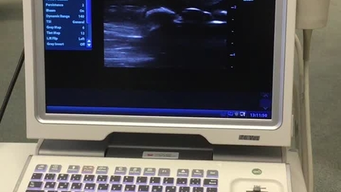 Thumbnail for entry Ultrasound of bovine ovary, corpus luteum and follicle