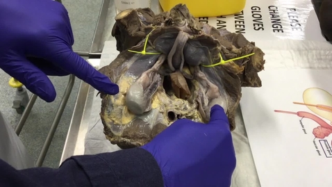 Thumbnail for Undescended testes in the colt foal