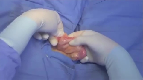 Thumbnail for entry Ovariohysterectomy in the large bitch