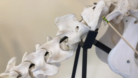 Thumbnail for Axial skeleton of the ox: Cervical vertebrae