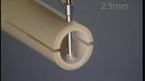 Thumbnail for Placing a lag screw to compress two pieces of bone together