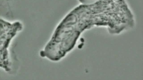 Thumbnail for Cell biology: Bacterial capsule