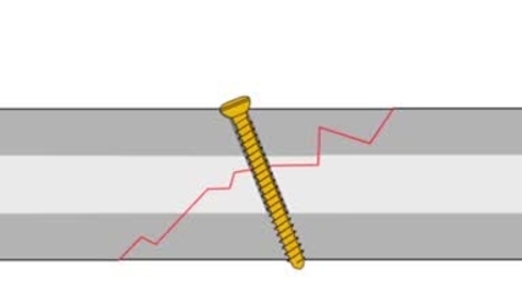 Thumbnail for Lag screw technique