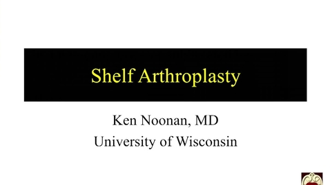 Thumbnail for entry Shelf Arthroplasty