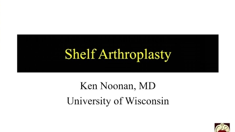 Thumbnail for Shelf Arthroplasty