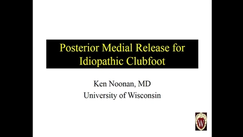 Thumbnail for entry Posterior Medial Release for Idiopathic Clubfoot