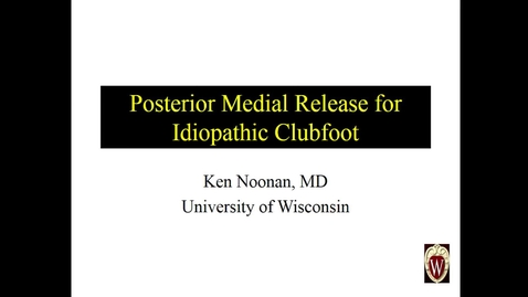 Thumbnail for Posterior Medial Release for Idiopathic Clubfoot