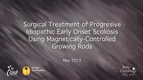 Thumbnail for Magnetically-Controlled Growing Rods for the Treatment of Early Onset Scoliosis