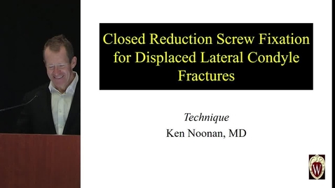Thumbnail for entry Closed Reduction Screw Fixation for Displaced Lateral Condyle Fractures