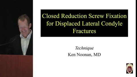 Thumbnail for Closed Reduction Screw Fixation for Displaced Lateral Condyle Fractures