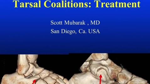 Thumbnail for entry Tarsal Coalitions: Treatment