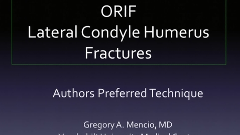 Thumbnail for entry ORIF Lateral Condyle Humerus Fracture