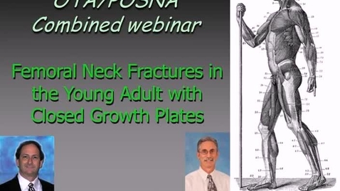 Thumbnail for entry Femoral Neck Fractures in the Young Adult with Closed Growth Plates