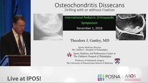 Thumbnail for entry Osteochondritis Dissecans Treatment