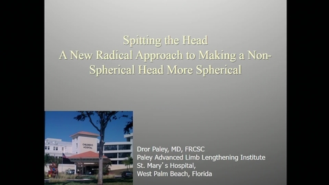 Thumbnail for entry Splitting the Head: A New Radical Approach to Making a Non-Spherical Head More Spherical