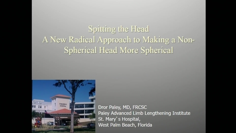 Thumbnail for Splitting the Head: A New Radical Approach to Making a Non-Spherical Head More Spherical