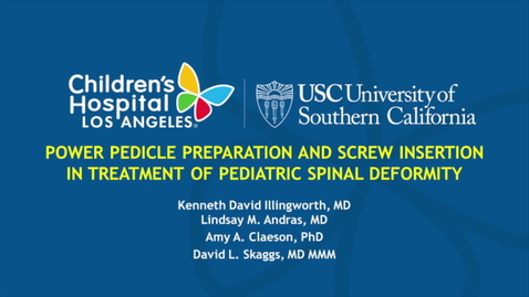 Thumbnail for Power Pedicle Preparation and Screw Insertion