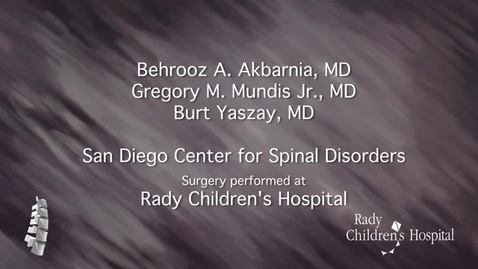 Thumbnail for Dual Growing Rod Surgery for the Treatment of Infantile Idiopathic Scoliosis