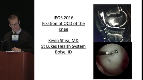 Thumbnail for Fixation of OCD of the Knee