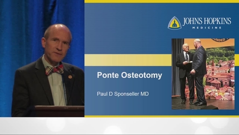Thumbnail for Ponte Osteotomies