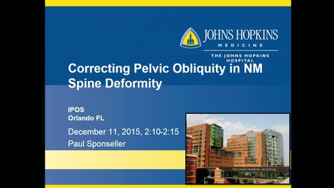 Thumbnail for Correcting Pelvic Obliquity in Neuromuscular Spine Deformity