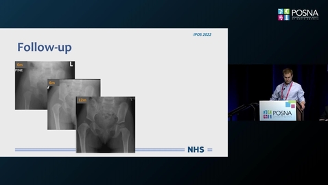 Thumbnail for IPOS® 2022: Intra and Postop Monitoring of Hip Vascularity: Baby to Young Adult