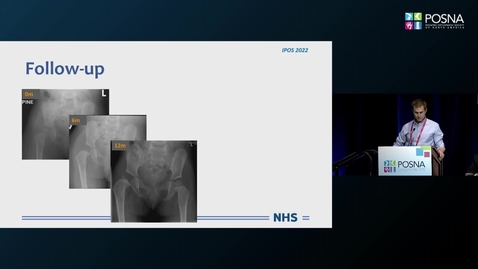 Thumbnail for entry IPOS® 2022: Intra and Postop Monitoring of Hip Vascularity: Baby to Young Adult