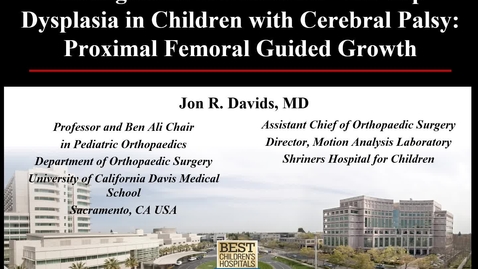 Thumbnail for Management of Neuromuscular Hip Dysplasia in Children with Cerebral Palsy: Proximal Femoral Guided Growth