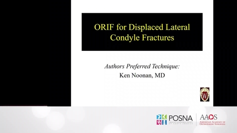 Thumbnail for entry ORIF for Displaced Lateral Condyle Fractures